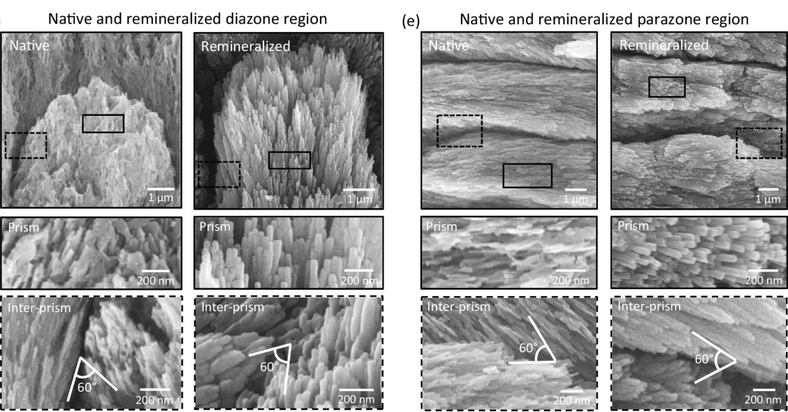 Recristallisation de l'émail dentaire par application de fines couches